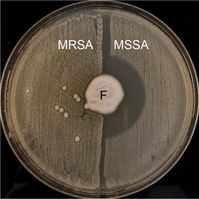 MRSA jezek2