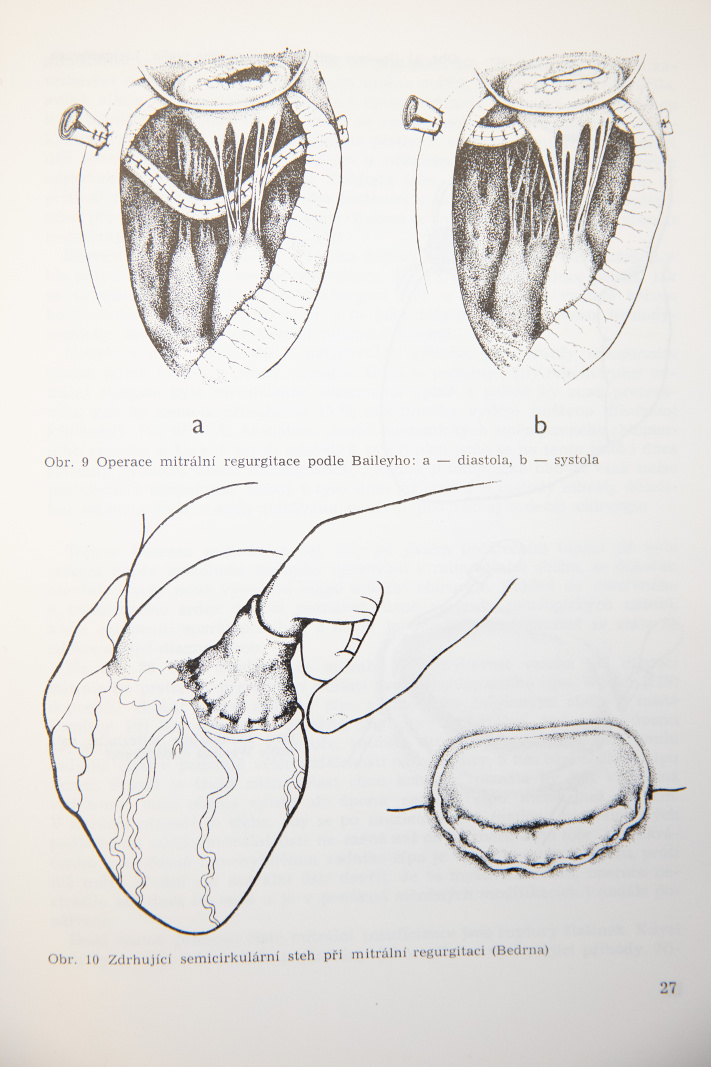 2021 11 08 Josef Bavor malir anatomie 12