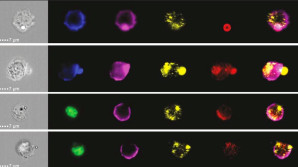 Ty buňky tam nejsou! Příběh nové studie imunologa Dobeše