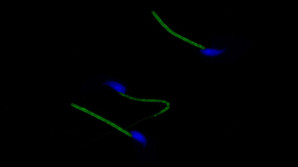 Spermie na cestě za vajíčkem chrání sirovodíkové brnění