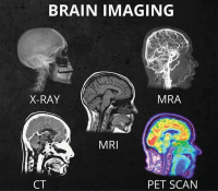 Head_Scans2_original