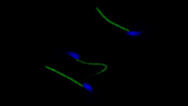 Spermie na cestě za vajíčkem chrání sirovodíkové brnění